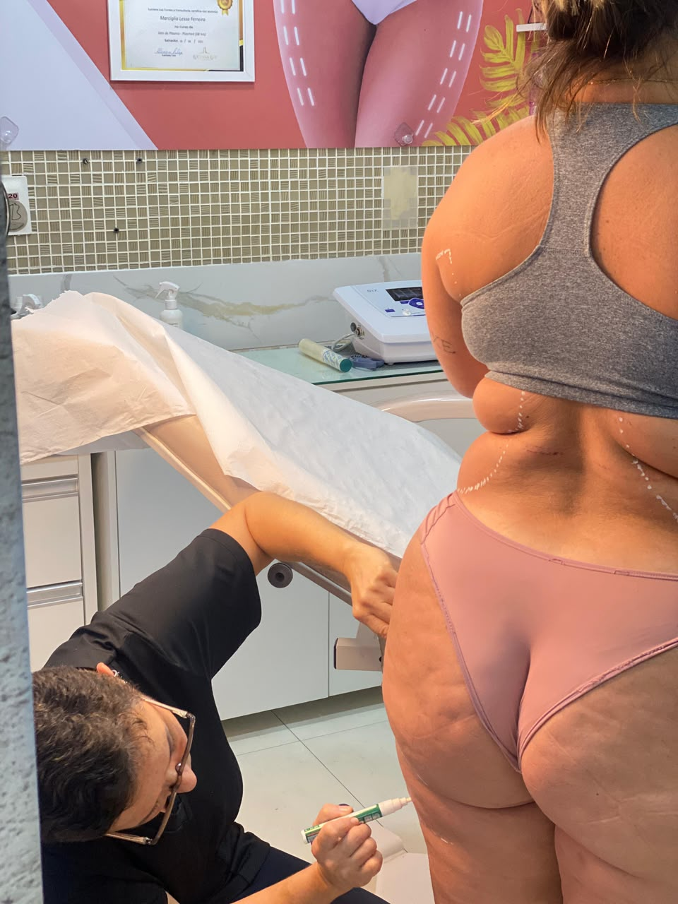 Avaliação corporal com marcações para análise estética